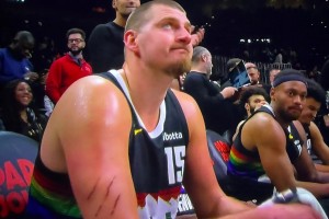 觸目驚心?。〖s基奇胳膊上的三道血痕是誰撓的？下手真狠啊??